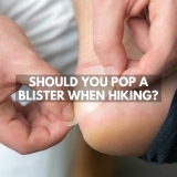 Should You Pop A Blister When Hiking?